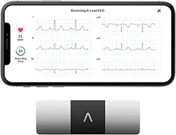 Mixed Reviews for KardiaMobile EKG Monitor: Functionality and Usability Issues