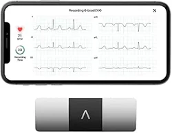 Mixed Reviews for AliveCor KardiaMobile 6L ECG Device